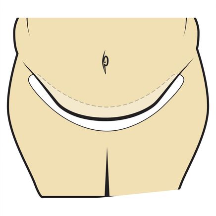 Tummy Liners, Set of 3-341619