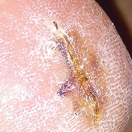 First Honey® Sterile Honey Ointment, 1oz.-369385