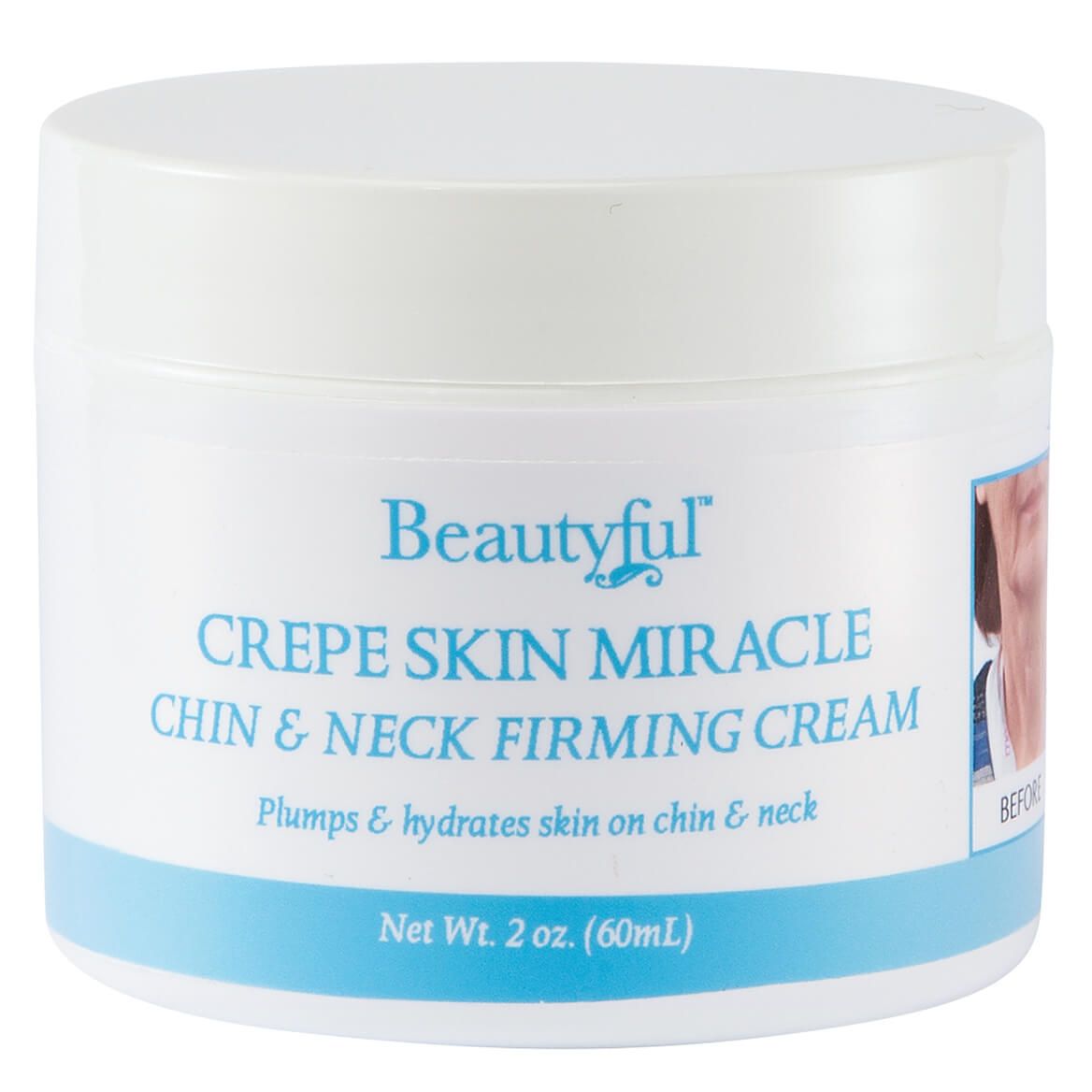 Beautyful™ Crepe Skin Miracle Chin & Neck Cream + '-' + 377481