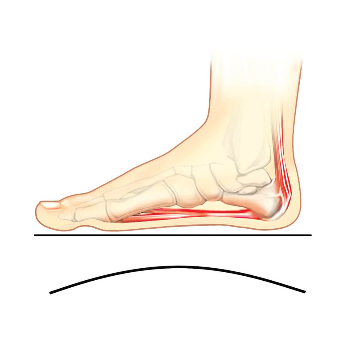 Plantar Fasciitis Slippers, Women's-370001