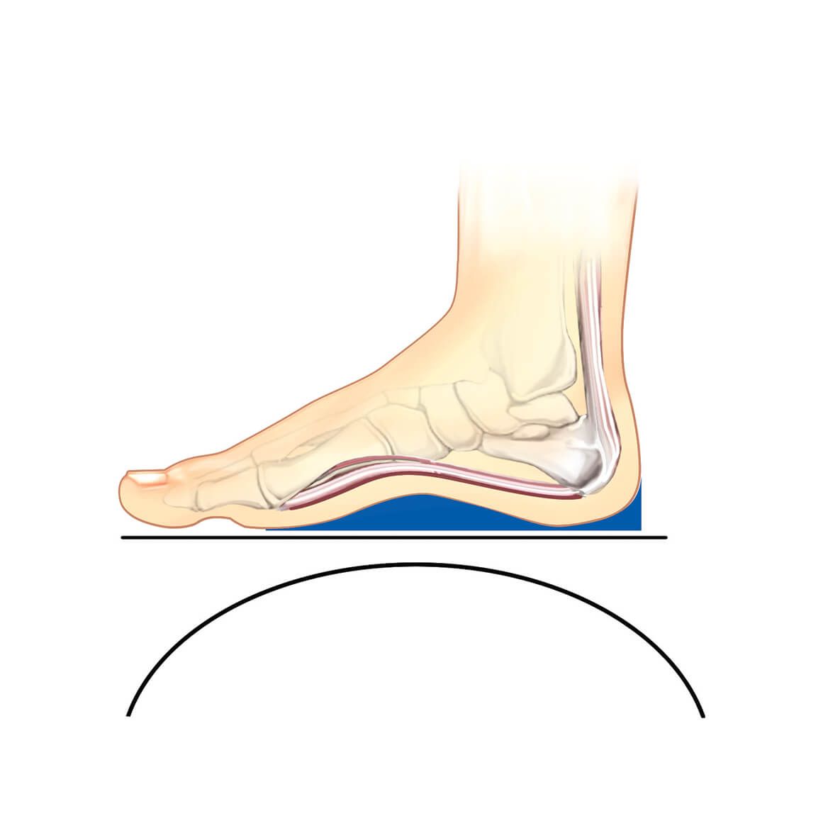 Plantar Fasciitis Slippers, Women's-370001