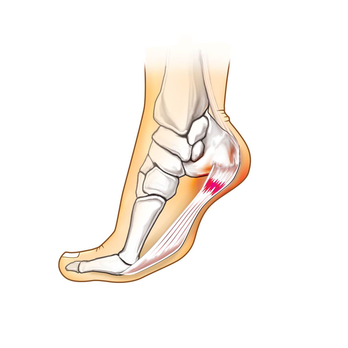 Plantar Fasciitis Slippers, Women's-370001