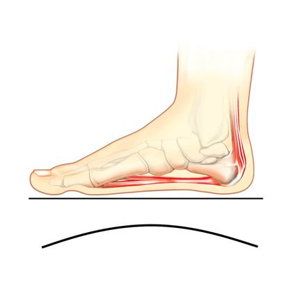View product details for Plantar Fasciitis Slippers, Men's