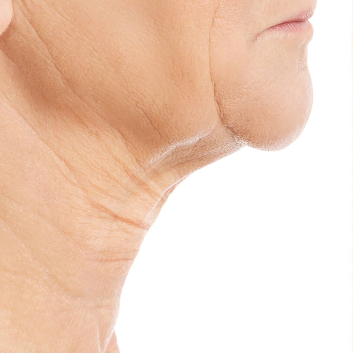 Crepe Be Gone Skin Firming Collagen Chin Masks Set of 2-370686