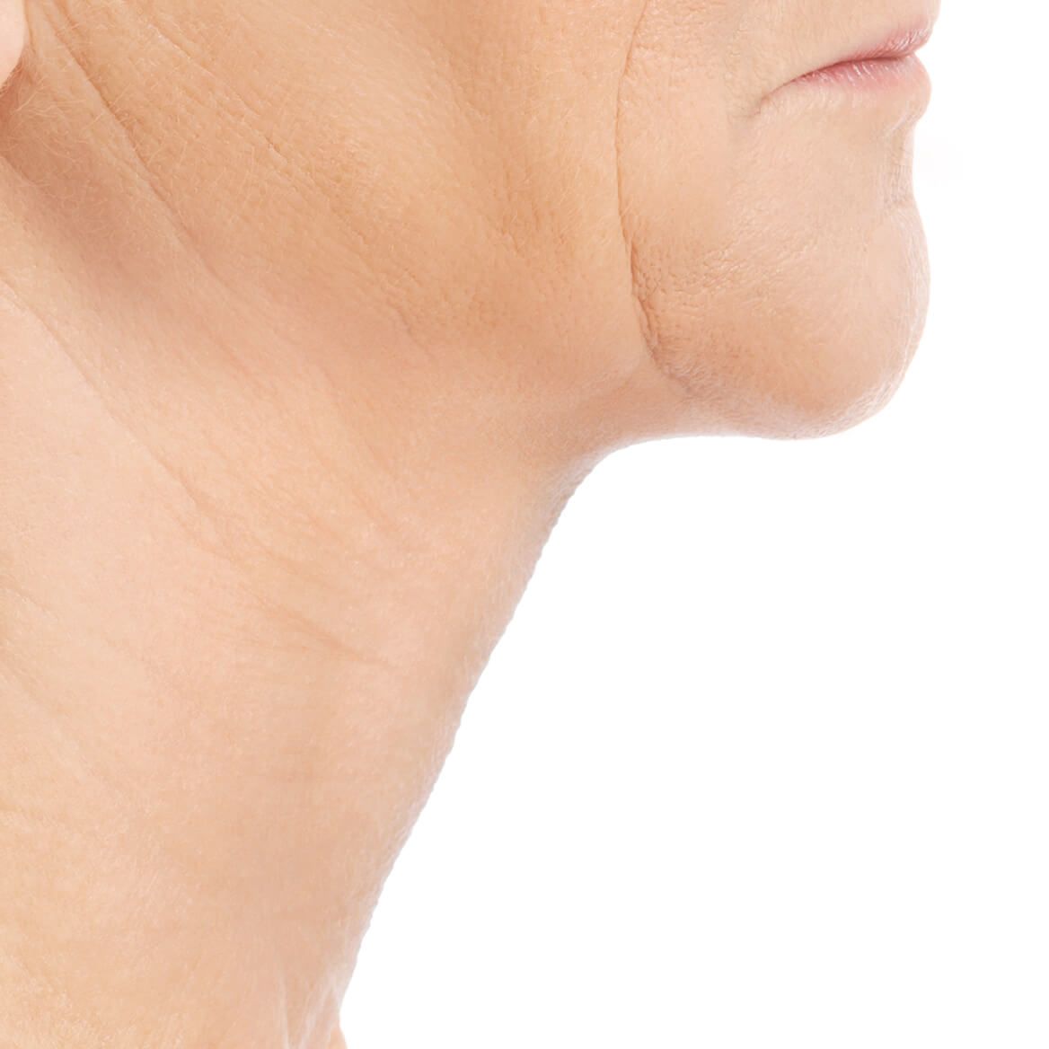 Crepe Be Gone Skin Firming Collagen Chin Masks Set of 2-370686