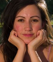 Image of a woman resting her chin on her hands