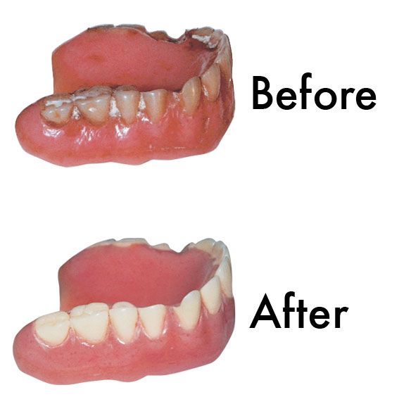 Sparkle Dent Denture Whitener-303361