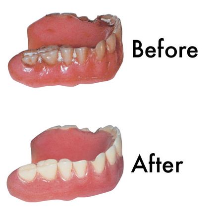 Sparkle Dent Denture Whitener-303361